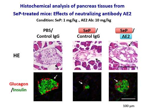 Figure 6 Pancreatic β-cell dysfunction induced by excess selenoprotein P and the improvement effects of its neutralizing antibody.