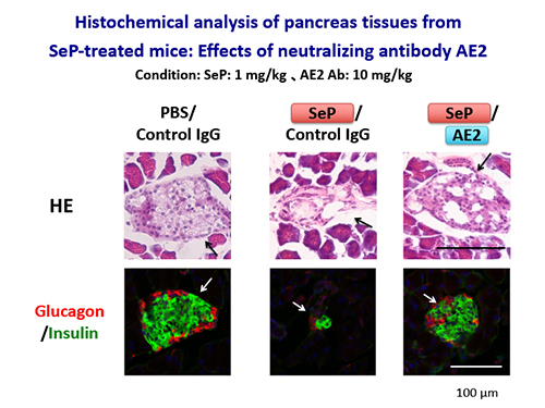 過剰セレノプロテインＰによる膵島障害および中和抗体による改善効果